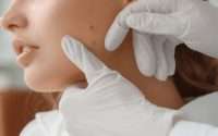 «Здоровье и молодость кожи: от удаления новообразований до глубокой биоревитализации»