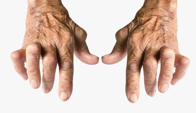 Как работает салазопирин при артритах: подробный разбор механизма действия