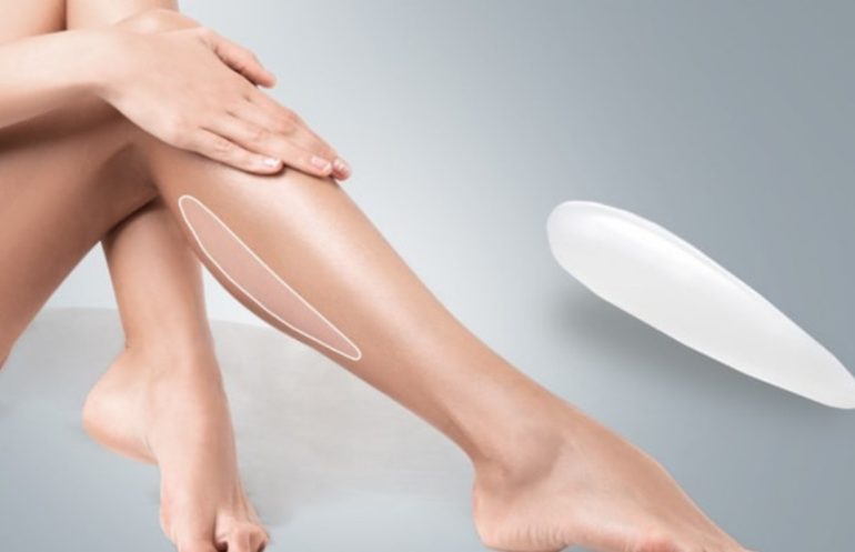 Круропластика: как изменить форму голеней