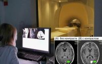 МРТ головного мозга с контрастом: зачем назначают, как подготовиться и как все проходит