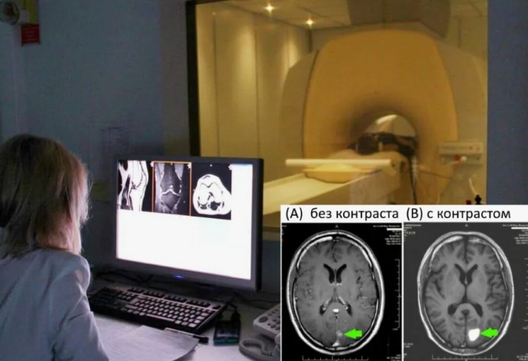 МРТ головного мозга с контрастом: зачем назначают, как подготовиться и как все проходит